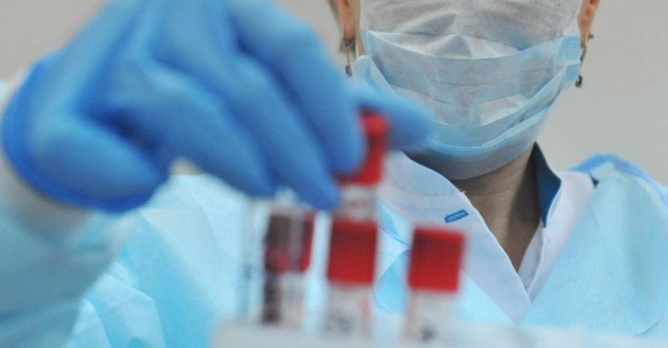 В Украине получен первый отрицательный результат у больного коронавирусом