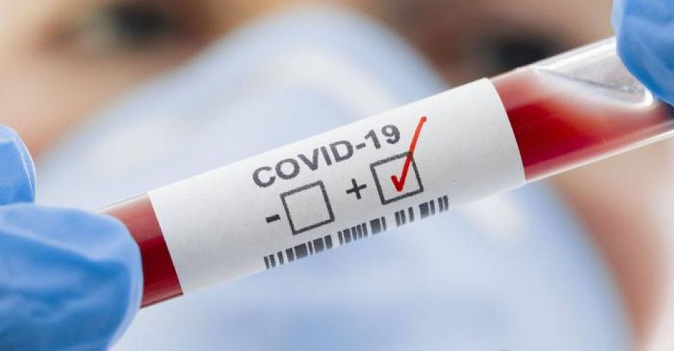 COVID-19 в Україні: 15 415 нових випадків зараження за добу