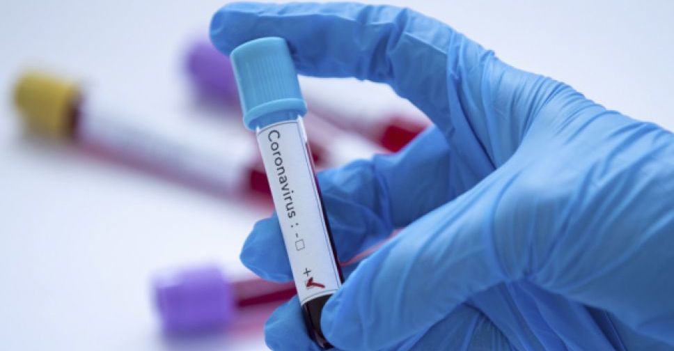 В Україні зафіксовано першу смерть людини, інфікованої коронавірусом - МОЗ