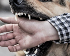На Миколаївщині від сказу помер чоловік: після укусу собаки відмовився від щеплень