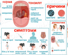 Підступний мікроб. Як побороти хронічний тонзиліт