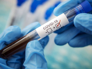 COVID-19 в Україні: 23 283 нових зараження та 816 смертей