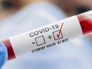 COVID-19 в Україні: 15 415 нових випадків зараження за добу
