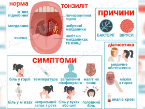 Підступний мікроб. Як побороти хронічний тонзиліт