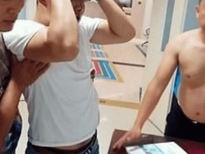 В Китае мужчина с топором в голове сам пришел в больницу