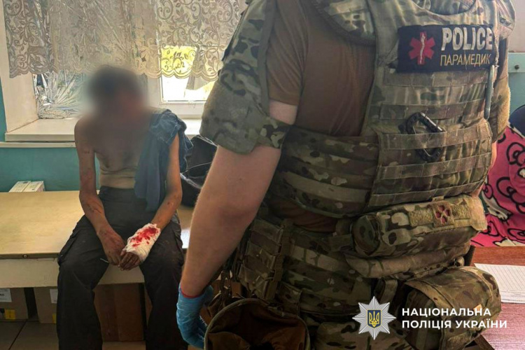10 цивільних поранені внаслідок російських обстрілів Донеччини за 25 липня