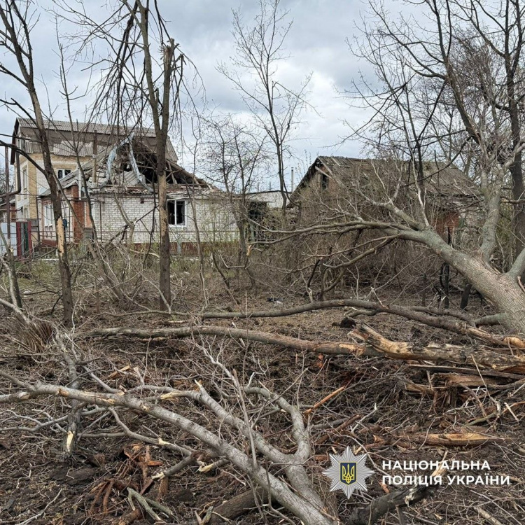 Серед поранених – дитина: внаслідок обстрілів Донеччини 15 квітня постраждали 6 людей