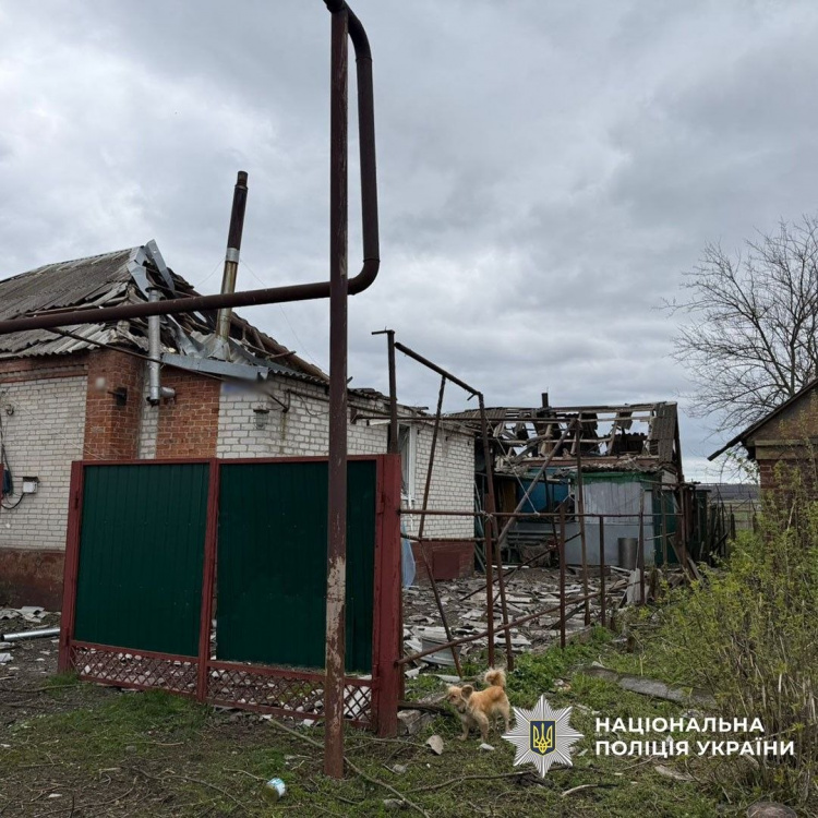 Серед поранених – дитина: внаслідок обстрілів Донеччини 15 квітня постраждали 6 людей