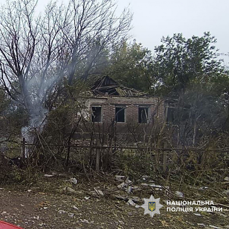 Четверо людей зазнали поранень внаслідок обстрілів Донеччини 1 жовтня