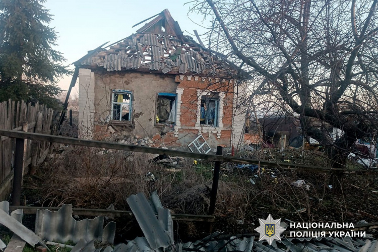 Через обстріли Донеччини 28 березня поранені п’ять людей, з них одна дитина