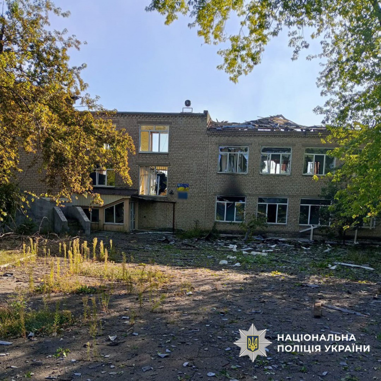 Загиблий і 11 поранених, з них двоє дітей: поліція Донеччини повідомила про наслідки обстрілів 21 вересня