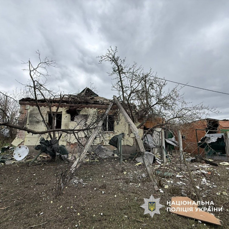 Серед поранених – дитина: внаслідок обстрілів Донеччини 15 квітня постраждали 6 людей